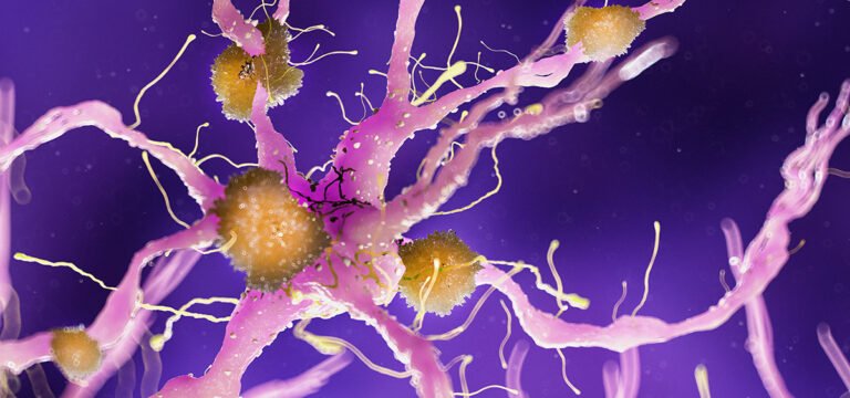 New Study Suggests THC and CBD Could Help Treat Agitation in Dementia Patients New Study Suggests THC and CBD Could Help Treat Agitation in Dementia Patients